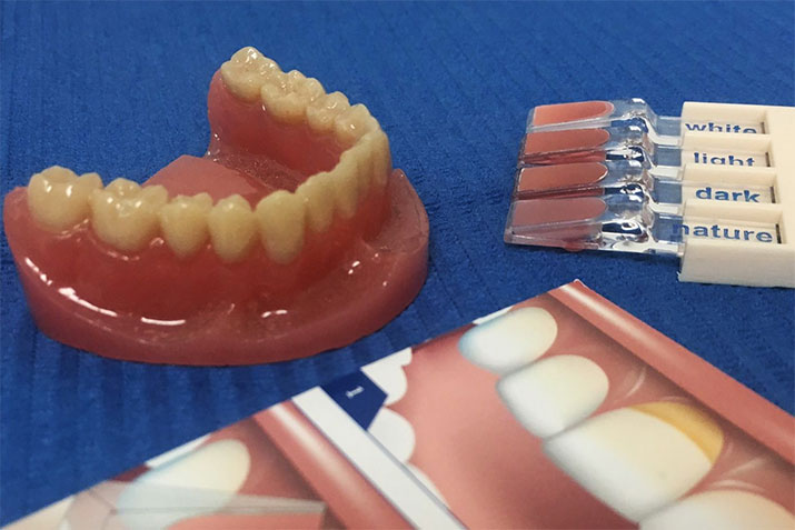 Kunststoffe für freiliegende Zahnhälse